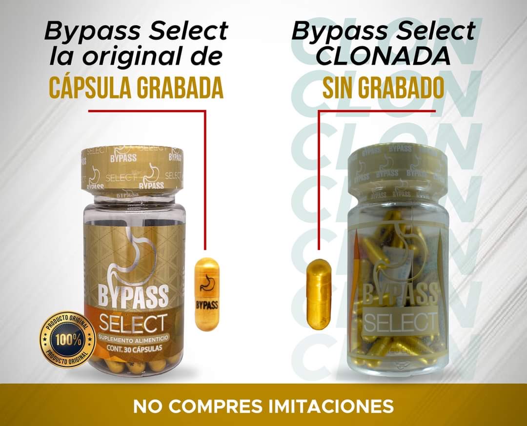 Bypass Select